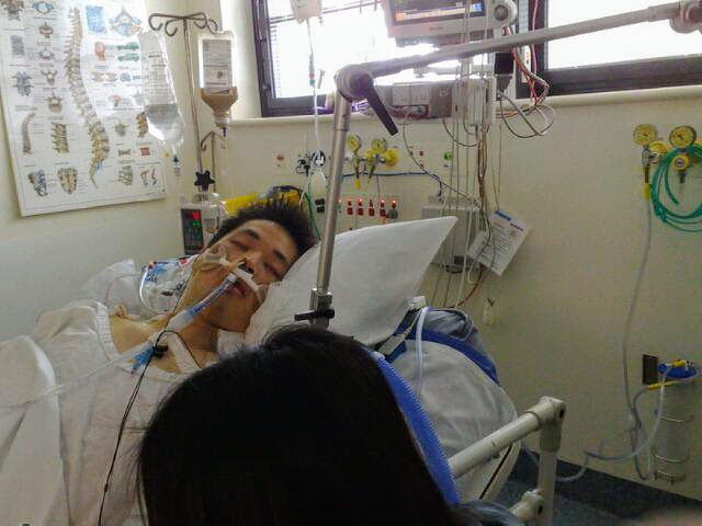 Coma